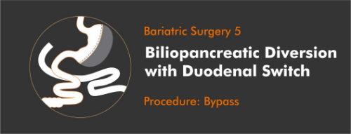 Biliopancreatic-Diversion-Doudenal-Weight-Loss-Surgery