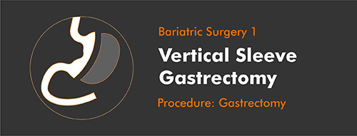 Verttical-Sleeve-Weight-Loss-Surgery-2